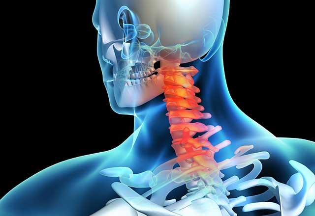 3D illustration showing a spinal injury